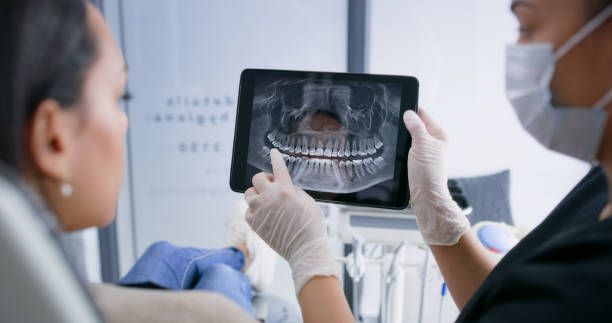 Licensed Tooth Extraction service in Naperville, IL - Smile Center Dentistry
